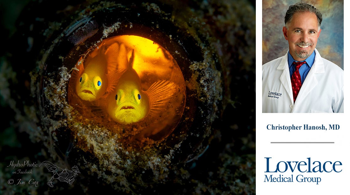 Photographer captures more underwater dives after hip replacement surgery