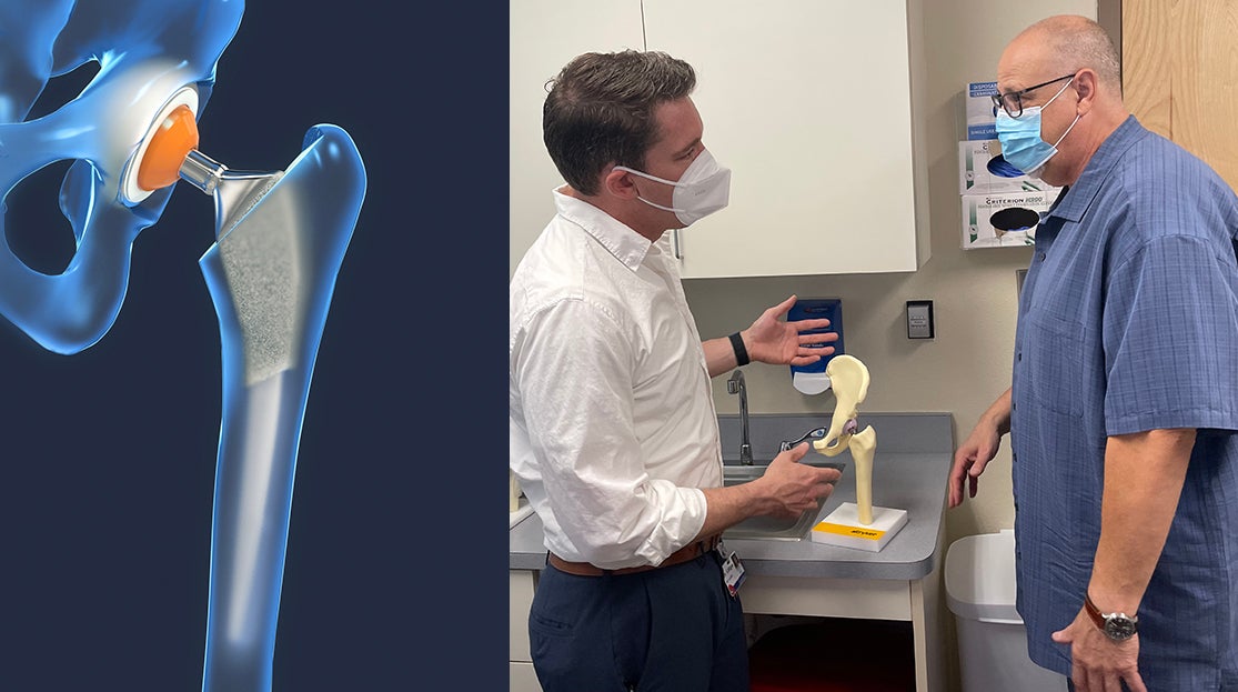 Photography, hiking and honeymoon on the horizon for double hip replacement patient